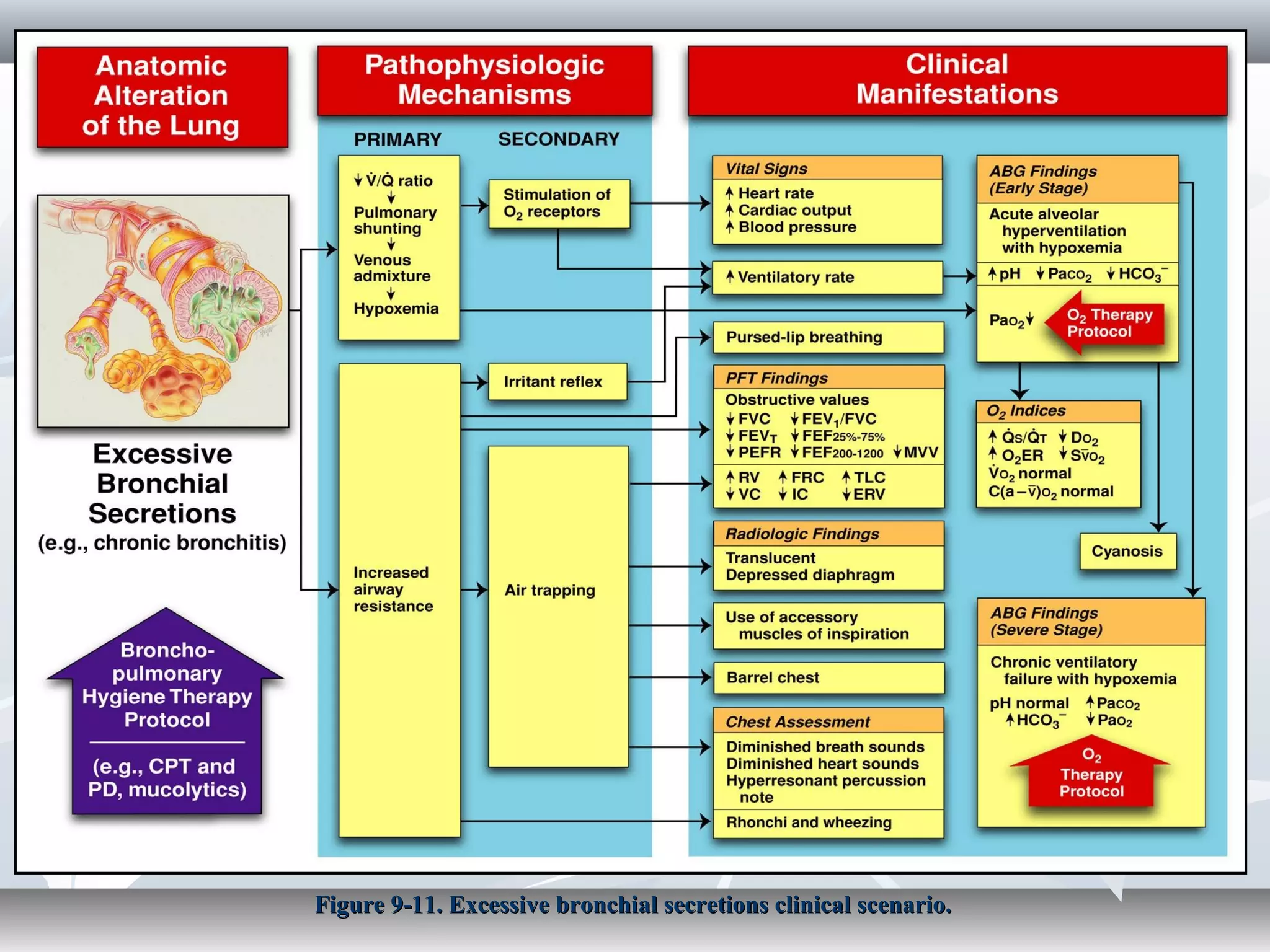 Asthma | PPT