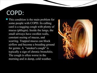 Asthma and COPD | PPT