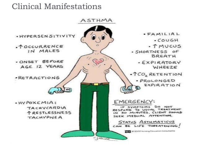 Bronchial asthma - classification and symptoms Bronchial asthma - classification and symptoms