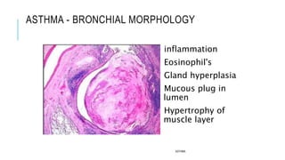 ASTHMA - BRONCHIAL MORPHOLOGY
inflammation
Eosinophil's
Gland hyperplasia
Mucous plug in
lumen
Hypertrophy of
muscle layer
ASTHMA
 