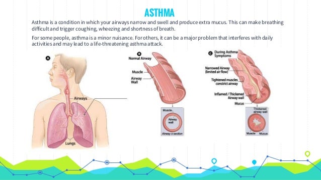asthma signs causes triggers and first aid asthma signs and symptoms