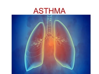 ASTHMA
 