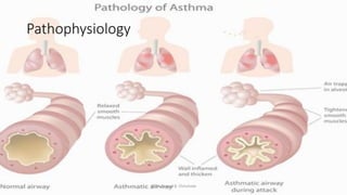 Pathophysiology
@ Dr. Prasad B. Chinchole
 