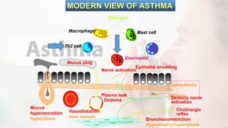 Eosinophil
Mast cell
Allergen
Th2 cell
MODERN VIEW OF ASTHMA
Vasodilatation
New vessels
Plasma leak
Oedema
Neutrophil
Mucus
hypersecretion
hyperplasia
Mucus plug
Macrophage
Bronchoconstriction
Hypertrophy/hyperplasia
Cholinergic
reflex
Epithelial shedding
Subepithelia
l
fibrosisSensory nerve
activation
Nerve activation
@ Dr. Prasad B. Chinchole
 