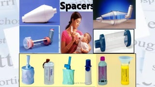 Spacers
@ Dr. Prasad B. Chinchole
 