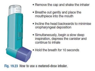 Asthma | PPTX