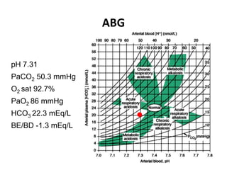 pH 7.31
PaCO2 50.3 mmHg
O2 sat 92.7%
PaO2 86 mmHg
HCO3 22.3 mEq/L
BE/BD -1.3 mEq/L
ABG
 