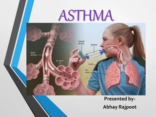 ASTHMA
Presented by-
Abhay Rajpoot
 