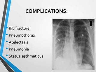 COMPLICATIONS:
•Rib fracture
•Pneumothorax
•Atelectasis
•Pneumonia
•Status asthmaticus
 