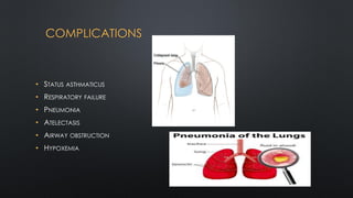 COMPLICATIONS
• STATUS ASTHMATICUS
• RESPIRATORY FAILURE
• PNEUMONIA
• ATELECTASIS
• AIRWAY OBSTRUCTION
• HYPOXEMIA
 