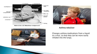 Asthma | PPT