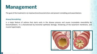 Bronchial Asthma Diagnosis & Management (2025) | PDF