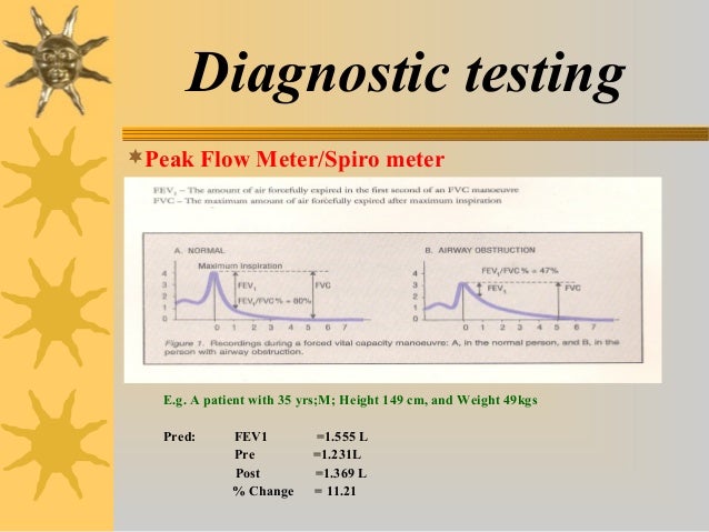 Asthma a clinical review and its management