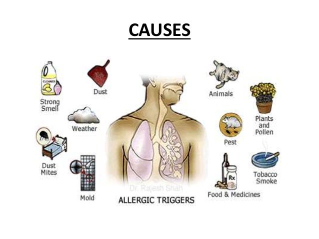 Asthma Overview Asthma Overview