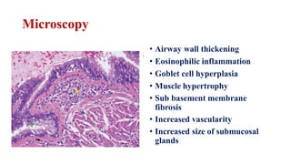 Microscopy
• Airway wall thickening
• Eosinophilic inflammation
• Goblet cell hyperplasia
• Muscle hypertrophy
• Sub basement membrane
fibrosis
• Increased vascularity
• Increased size of submucosal
glands
 