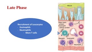 Late Phase
Recruitment of Leucocytes
- Eosinophils
- Neutrophils
- More T cells
 