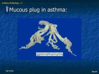 Mucous plug in asthma: 06/16/09 