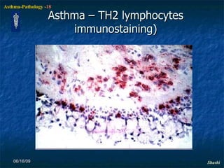 Asthma – TH2 lymphocytes immunostaining) 06/16/09 