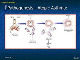 Pathogenesis - Atopic Asthma: 06/16/09 