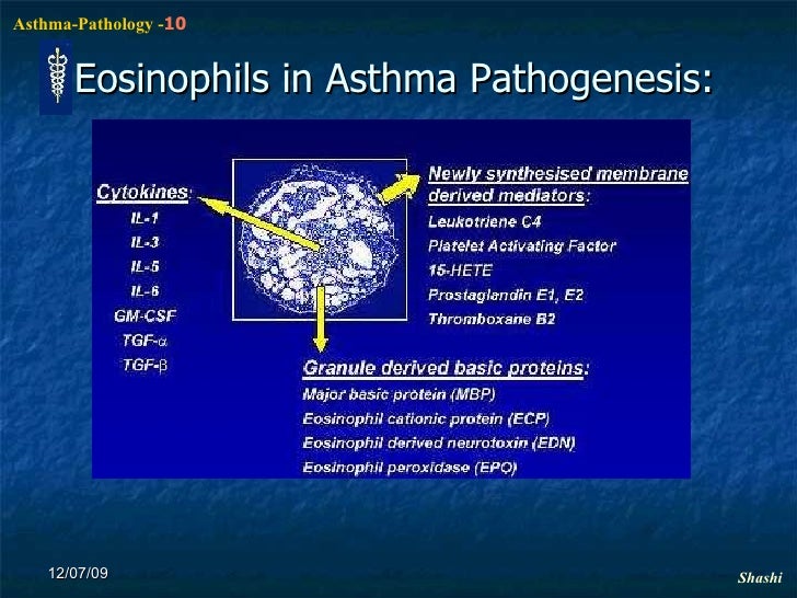 Asthma Pathophysiology N Asthma Pathophysiology N