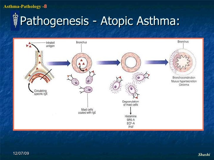 Asthma Pathophysiology N