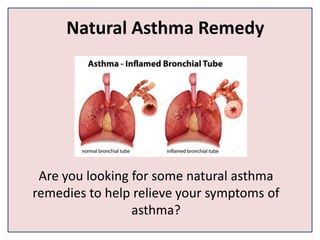 Natural Asthma Remedy
Are you looking for some natural asthma
remedies to help relieve your symptoms of
asthma?
 
