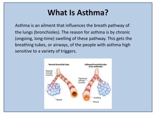 What Is Asthma?
Asthma is an ailment that influences the breath pathway of
the lungs (bronchioles). The reason for asthma is by chronic
(ongoing, long-time) swelling of these pathway. This gets the
breathing tubes, or airways, of the people with asthma high
sensitive to a variety of triggers.