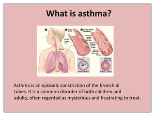What is asthma?
Asthma is an episodic constriction of the bronchial
tubes. It is a common disorder of both children and
adults, often regarded as mysterious and frustrating to treat.
 