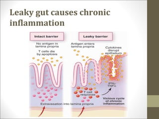 Leaky gut causes chronic
inflammation
 