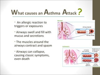 What causes an Asthma Attack ?
 • An allergic reaction to
 triggers or exposures
 • Airways swell and fill with
 mucus and secretions
 • The muscles around the
 airways contract and spasm
 • Airways can collapse,
 causing classic symptoms,
 even death
 