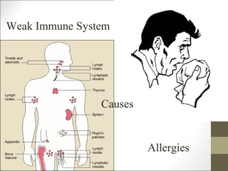 Weak Immune System




                Causes


                         Allergies
 