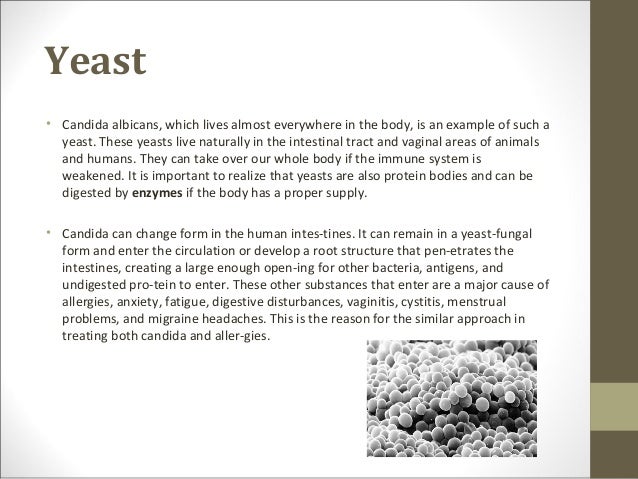 How To Treat Flatulence And Bloating Naturally How To Treat Flatulence And Bloating Naturally