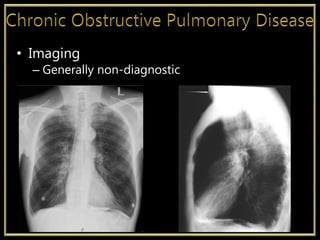 • Imaging
– Generally non-diagnostic
 
