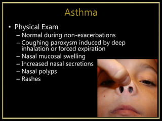 • Physical Exam
– Normal during non-exacerbations
– Coughing paroxysm induced by deep
inhalation or forced expiration
– Nasal mucosal swelling
– Increased nasal secretions
– Nasal polyps
– Rashes
 