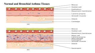 Normal and Bronchial Asthma Tissues
 