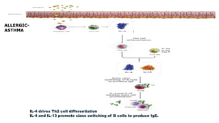 IL-4 drives Th2 cell differentiation
IL-4 and IL-13 promote class switching of B cells to produce IgE.
ALLERGIC-
ASTHMA
 