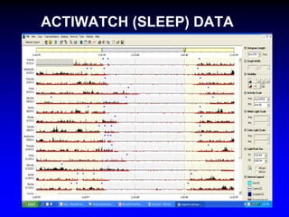 ACTIWATCH (SLEEP) DATA

 