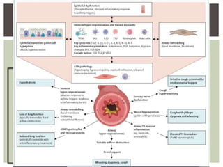 Pathophysio Sample asthma basics, pathophysio,phenotypes.pdf