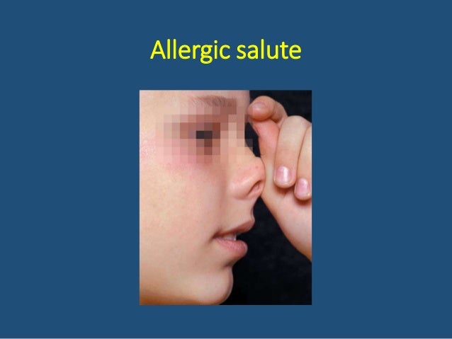 allergic salute allergic salute