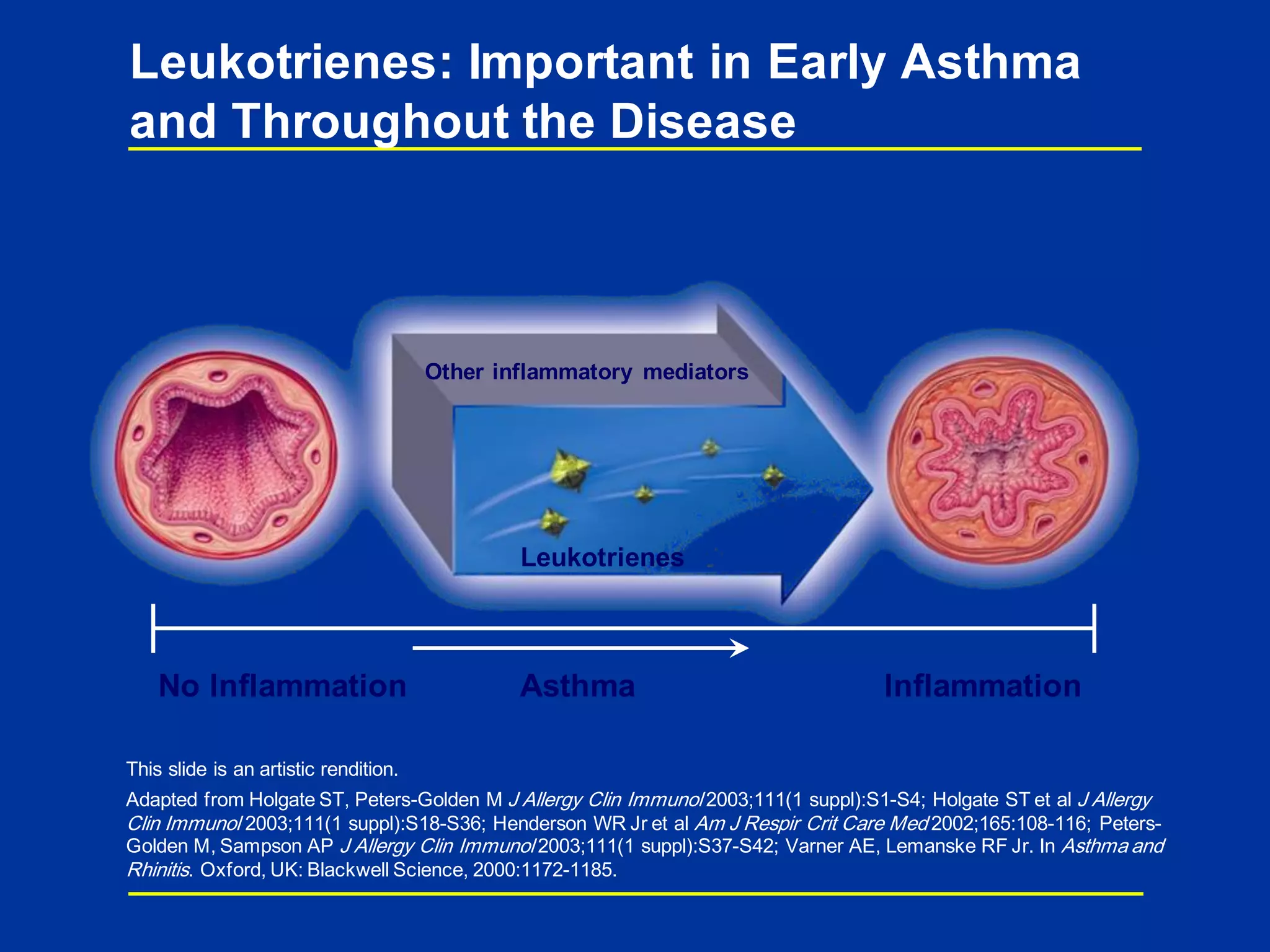 Leukotrienes
Other inflammatory mediators
This slide is an artistic rendition.
Adapted from Holgate ST, Peters-Golden M J Allergy Clin Immunol 2003;111(1 suppl):S1-S4; Holgate ST et al J Allergy
Clin Immunol 2003;111(1 suppl):S18-S36; Henderson WR Jr et al Am J Respir Crit Care Med 2002;165:108-116; Peters-
Golden M, Sampson AP J Allergy Clin Immunol 2003;111(1 suppl):S37-S42; Varner AE, Lemanske RF Jr. In Asthma and
Rhinitis. Oxford, UK: Blackwell Science, 2000:1172-1185.
No Inflammation InflammationAsthma
Leukotrienes: Important in Early Asthma
and Throughout the Disease
 