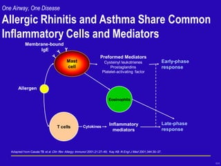 111
One Airway, One Disease
Allergic Rhinitis and Asthma Share Common
Inflammatory Cells and Mediators
Adapted from Casale TB et al Clin Rev Allergy Immunol 2001;21:27–49; Kay AB N Engl J Med 2001;344:30–37.
Early-phase
response
Late-phase
response
T cells
Inflammatory
mediators
Allergen
Cytokines
Preformed Mediators
Cysteinyl leukotrienes
Prostaglandins
Platelet-activating factor
Eosinophils
Membrane-bound
IgE
Mast
cell
 