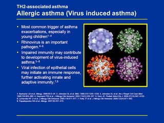 TH2-associated asthma
Allergic asthma (Virus induced asthma)
 