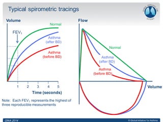 © Global Initiative for Asthma
Time (seconds)
Volume
Note: Each FEV1 represents the highest of
three reproducible measurements
Typical spirometric tracings
FEV1
1 2 3 4 5
Normal
Asthma
(after BD)
Asthma
(before BD)
Flow
Volume
Normal
Asthma
(after BD)
Asthma
(before BD)
GINA 2014
 