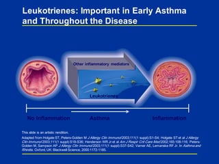 Leukotrienes
Other inflammatory mediators
This slide is an artistic rendition.
Adapted from Holgate ST, Peters-Golden M J Allergy Clin Immunol 2003;111(1 suppl):S1-S4; Holgate ST et al J Allergy
Clin Immunol 2003;111(1 suppl):S18-S36; Henderson WR Jr et al Am J Respir Crit Care Med 2002;165:108-116; Peters-
Golden M, Sampson AP J Allergy Clin Immunol 2003;111(1 suppl):S37-S42; Varner AE, Lemanske RF Jr. In Asthma and
Rhinitis. Oxford, UK: Blackwell Science, 2000:1172-1185.
No Inflammation InflammationAsthma
Leukotrienes: Important in Early Asthma
and Throughout the Disease
 