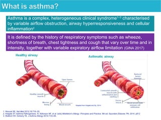1. Wenzel SE. Nat Med 2012;18:716–25;
2. Holgate ST. Asthma Pathogenesis. In: Adkinson NF, et al. (eds) Middleton's Allergy: Principles and Practice. 8th ed. Saunders Elsevier, PA: 2014. p812
3. Walford HH, Doherty TA. J Asthma Allergy 2014;7:53–65.
Asthma is a complex, heterogeneous clinical syndrome1 3‒
characterised
by variable airflow obstruction, airway hyperresponsiveness and cellular
inflammation2
It is defined by the history of respiratory symptoms such as wheeze,
shortness of breath, chest tightness and cough that vary over time and in
intensity, together with variable expiratory airflow limitation (GINA 2017)
Adapted from Holgate and Sly, 2014.2
 
