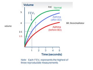 FVC
4
5
1.5
2.5
BD: Bronchodilator
volume
 