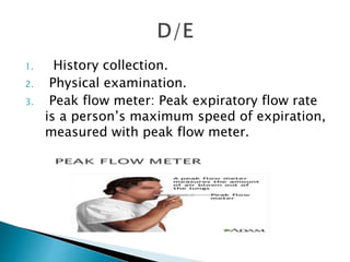 1. History collection.
2. Physical examination.
3. Peak flow meter: Peak expiratory flow rate
is a person’s maximum speed of expiration,
measured with peak flow meter.
 