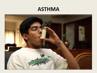 ASTHMA
 