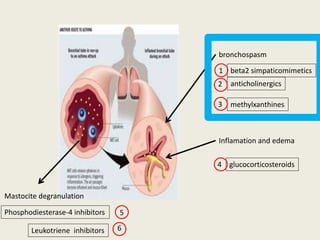 bronchospasm
anticholinergics
methylxanthines
beta2 simpaticomimetics
Inflamation and edema
glucocorticosteroids
Mastocite degranulation
Phosphodiesterase-4 inhibitors
1
2
3
4
5
Leukotriene inhibitors 6
 