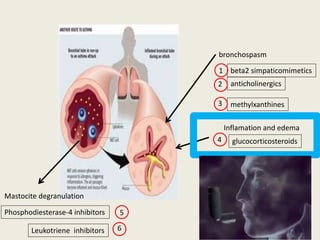 bronchospasm
anticholinergics
methylxanthines
beta2 simpaticomimetics
Inflamation and edema
glucocorticosteroids
Mastocite degranulation
Phosphodiesterase-4 inhibitors
1
2
3
4
5
Leukotriene inhibitors 6
 